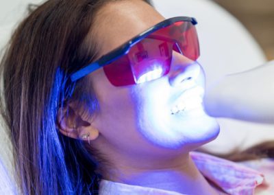 femme sous lumière blanchiments dentaire