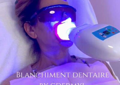 cover video blanchiment dentaire