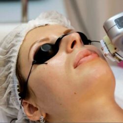 cover video laser-réjunévation visage femme