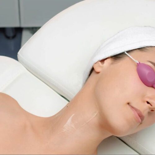 cover video laser réjuvénation cou femme