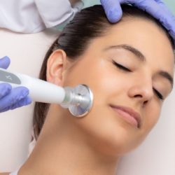 plasma froid, plasma lift joue