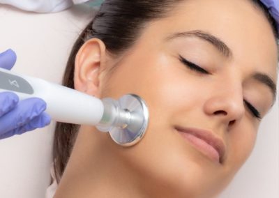 plasma froid, plasma lift joue