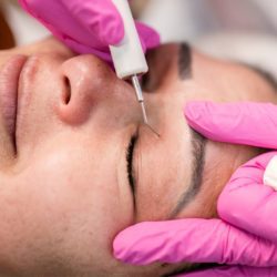 plasma froid, plasma lift yeux