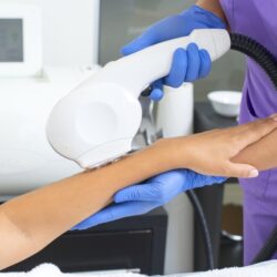 depilation demi-bras