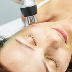 dépilation laser diode visage