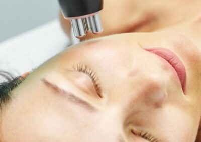 dépilation laser diode visage