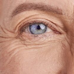 plasma froid paupieres inférieures