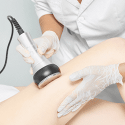 traitement minceur par Radiofréquence et cavitation