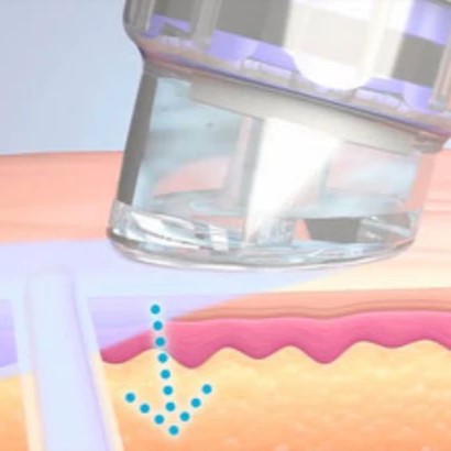 beauty clean step 2 beauty clean step 2